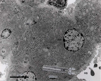 【肝細胞(ブタの肝臓)】×7.000 挿入写真 細胞膜(×100,000)