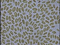 Fistulifera solaris 顕微鏡写真