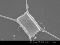 珪藻類　電子顕微鏡写真