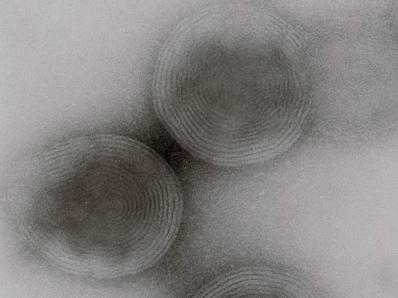 【ネガティブ染色法によるリポソーム多層構造の観察】×200,000 TEM