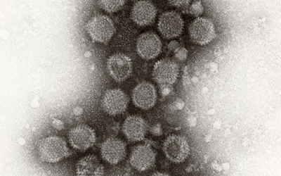 【ネガティブ染色法によるトリアデノウイルスの観察】×100,000 TEM