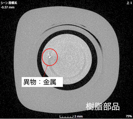 内部観察 − 異物の確認​