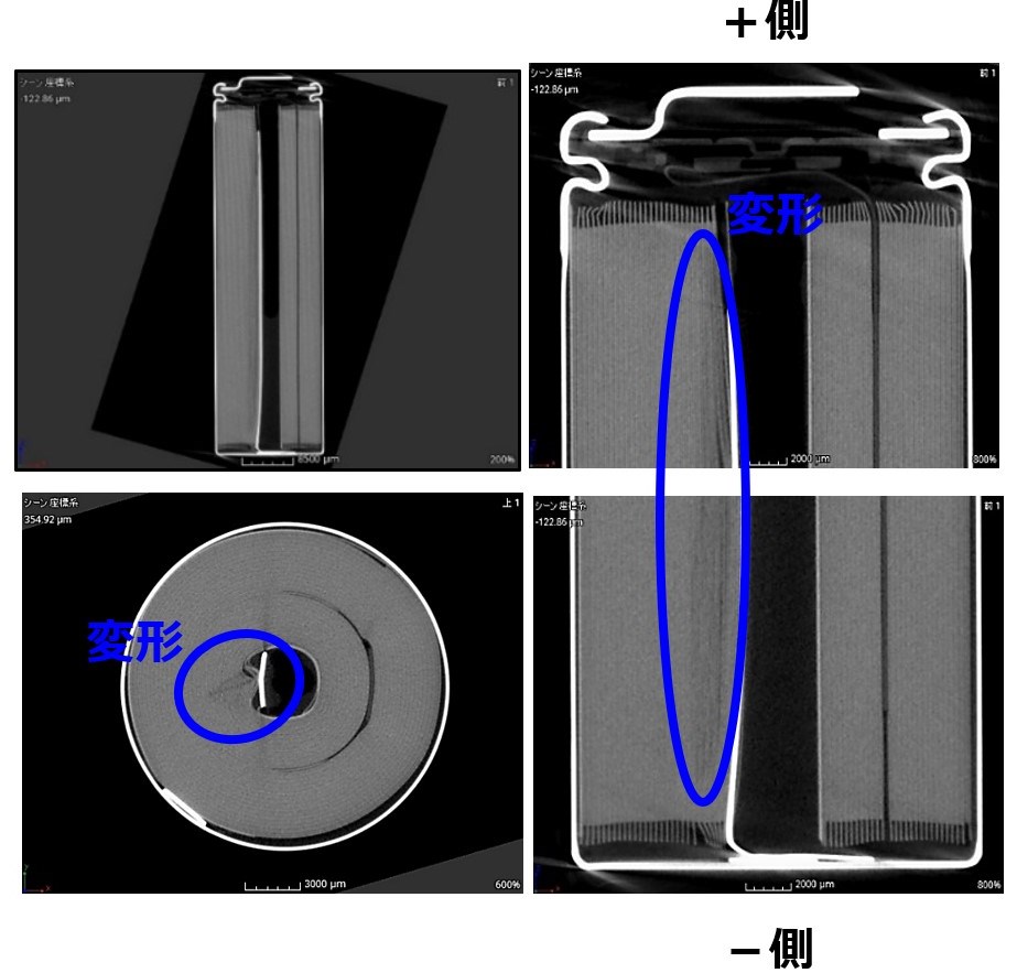 X線CT検査、透過X線検査
